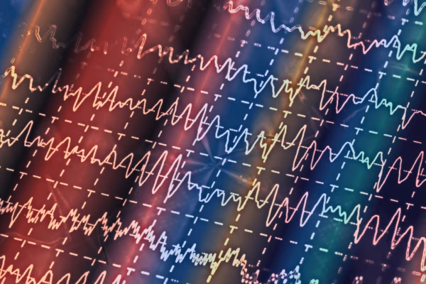 EEG printout